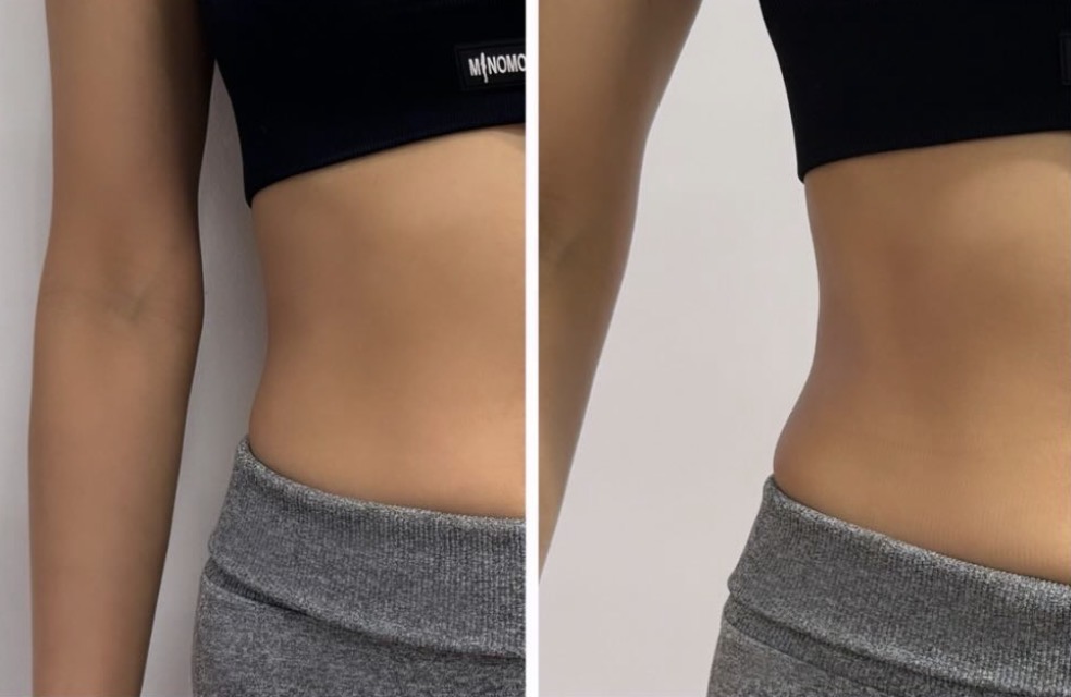 Before / After 01