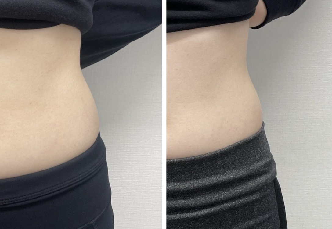 Before / After 02