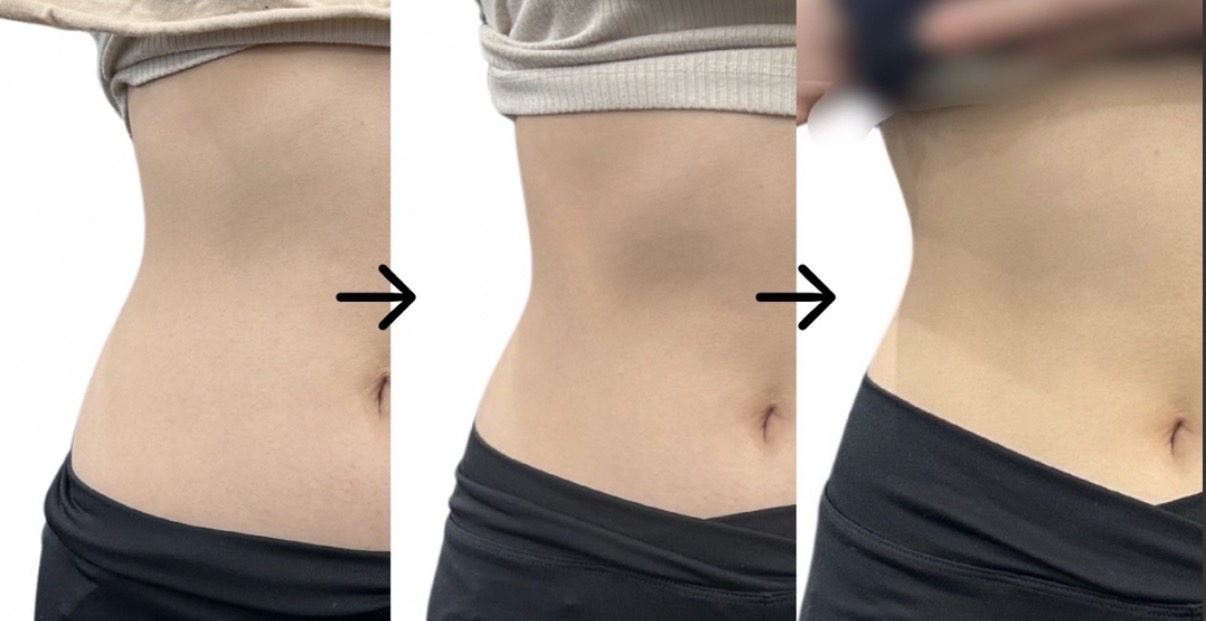 Before / After 04