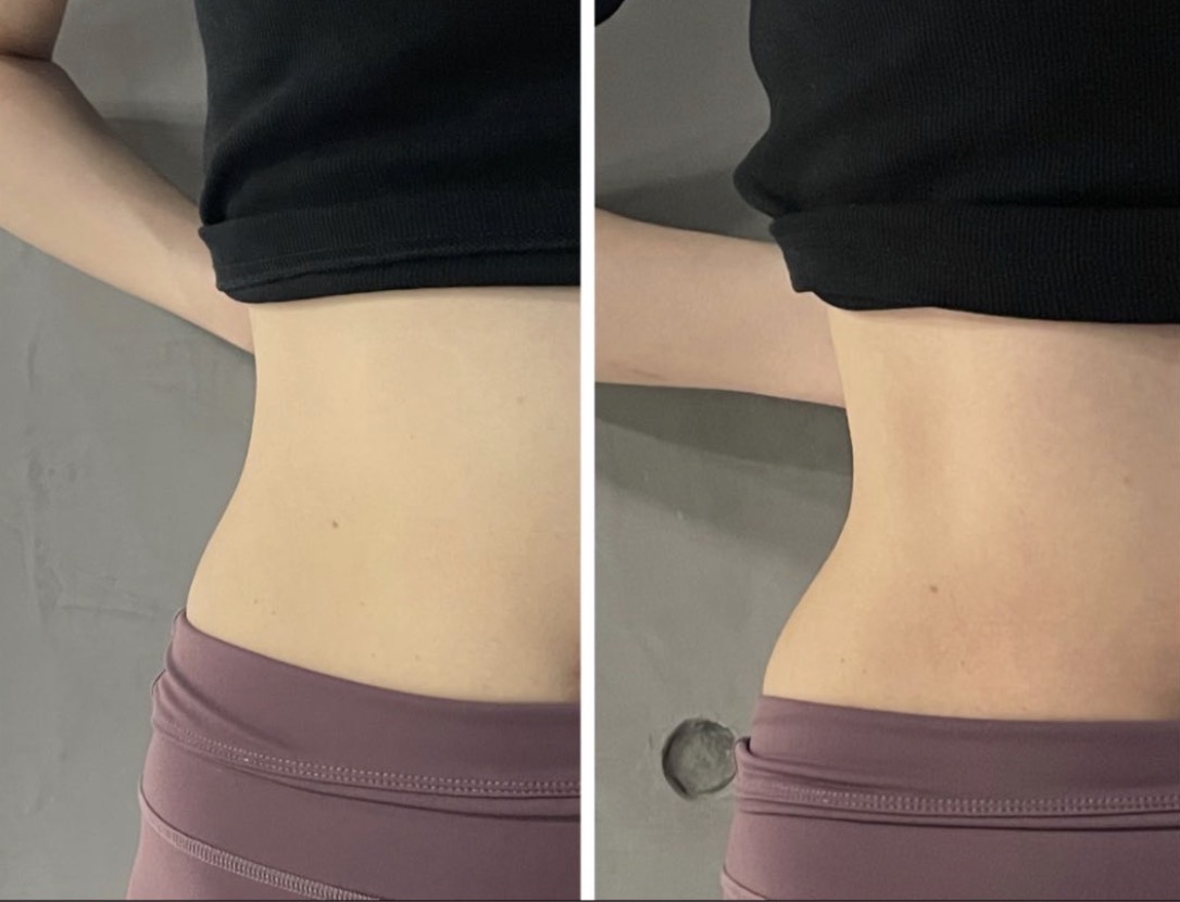 Before / After 05