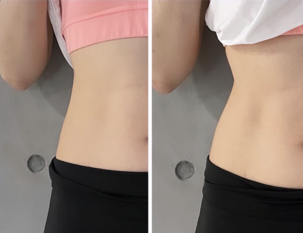 Before / After 06