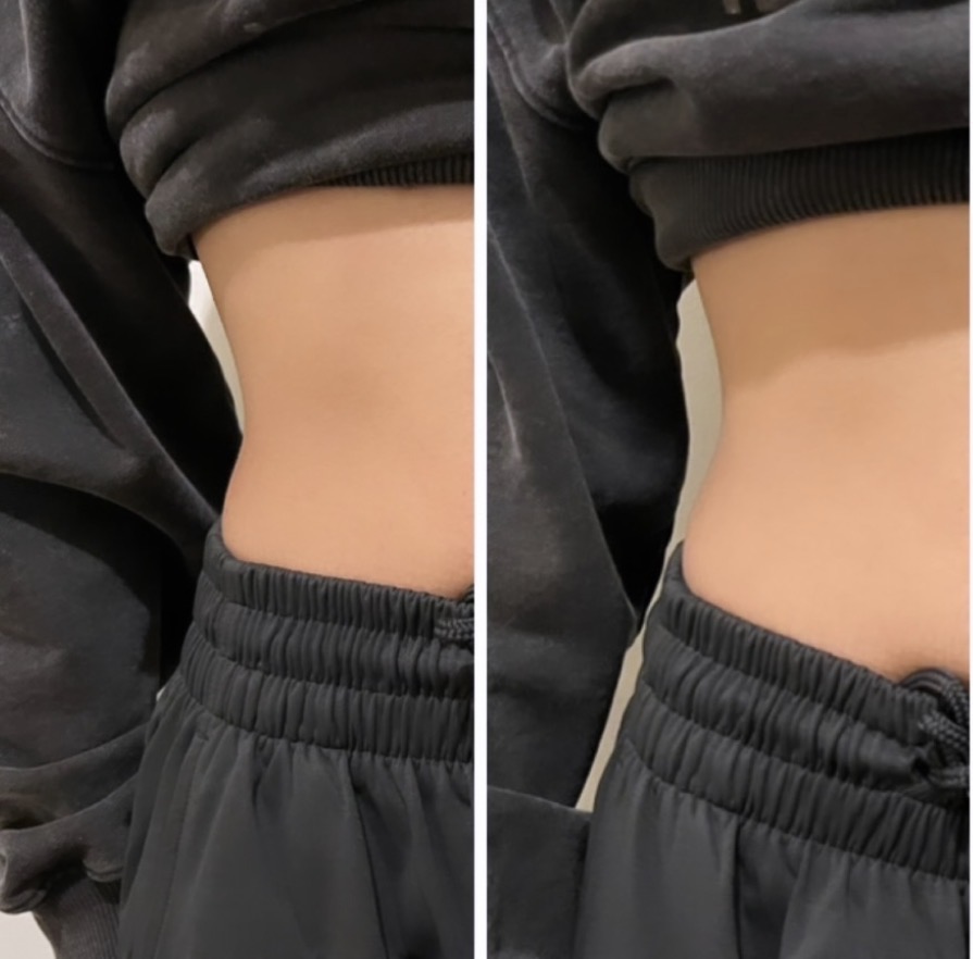 Before / After 07