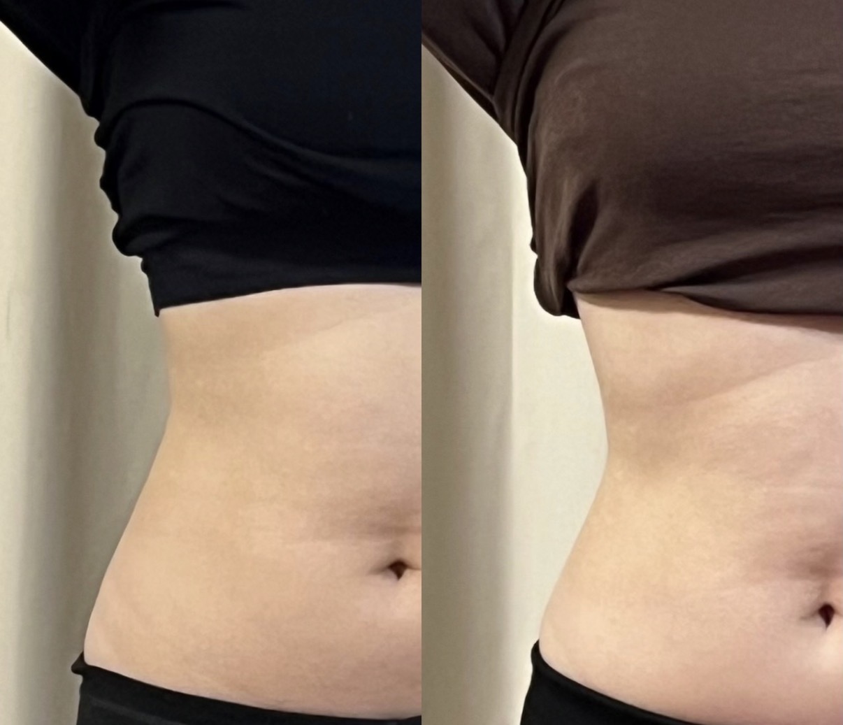 Before / After 08